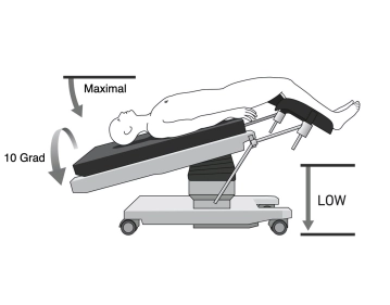 513 Lagerung Kopftief maximal initial.jpg