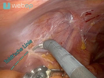 507_04 Toldt Linie.jpg