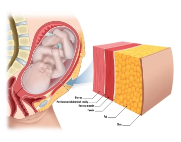 Piel y tejido subcutáneo