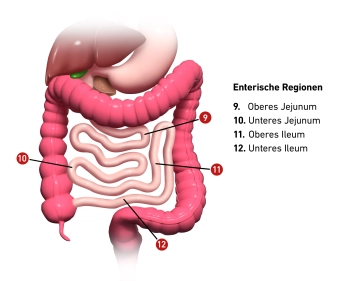 Índice de Sugarbaker (Índice de Cáncer Peritoneal) 2