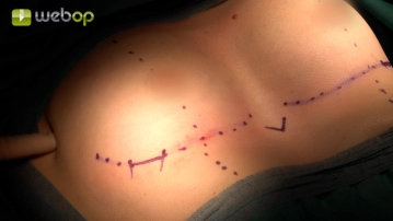 Definition of topographical landmarks