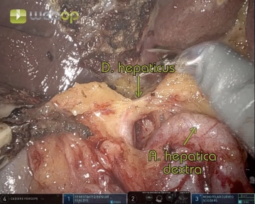 513 8 D hepaticus2.jpg