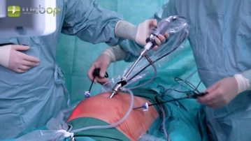 Trocar placement; Assessment of findings