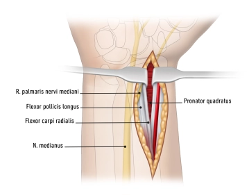 Access modified according to Henry
