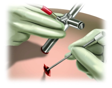 Colocación de la ayuda de introducción