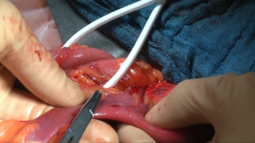 Dissecting the intestinal wall