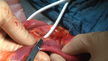 Dissecting the intestinal wall