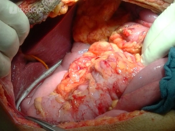 Irrigation and drains