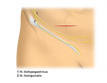 Skin incision