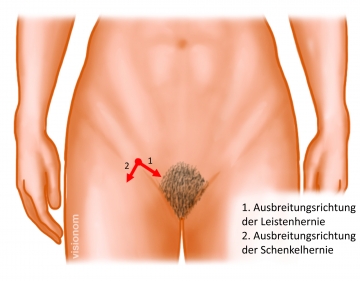 Preoperative diagnostic work-up