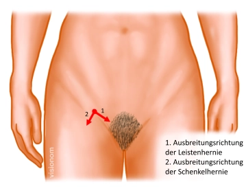 Preoperative Diagnostics