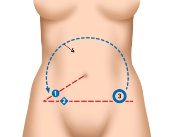 preoperative diagnostics