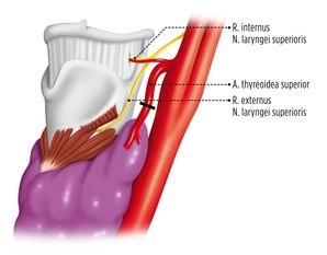 Interruption of the Upper Pole Vessels