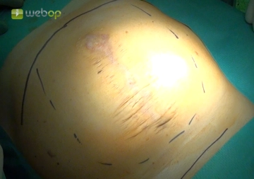 Marking the 'landmarks'