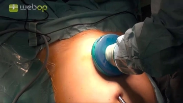 Colocación del puerto manual