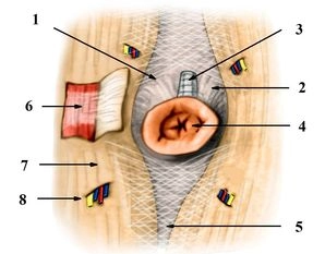 Special anatomy of the umbilical region