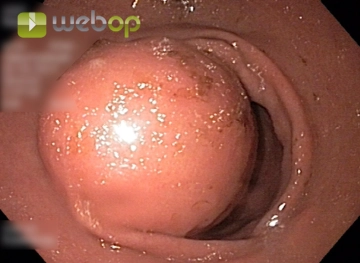 Preoperative Assessment