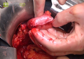 Sección del estómago postpilórica