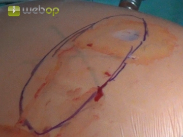 Measuring the Mesh Size