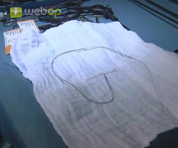 Introducción de la sonda con electrodos