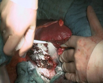 Instrumentos especiales y sistemas de sujeción