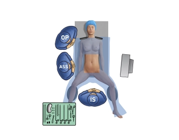 OP – Configuración