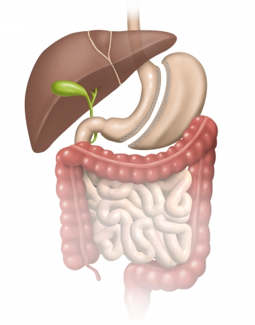 Sleeve gastrectomy (SG)