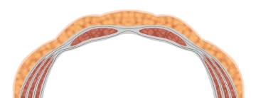 Structure of the Anterior Abdominal Wall