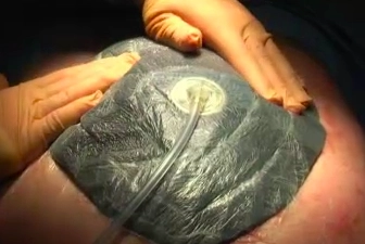 Application of the T.R.A.C.® System