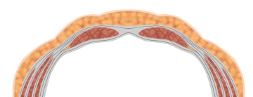 Fasciae and Peritoneum