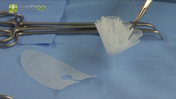 Special instruments and holding systems