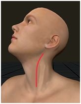 Left cervical access