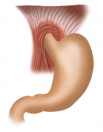 Surgical anatomy of the stomach