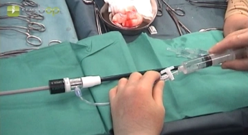 Preparing the main body