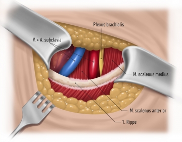 Exposing the anatomic structures superior to the first rib