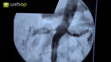 Verification angiography