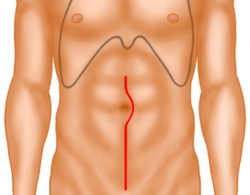 Skin incision and exposure