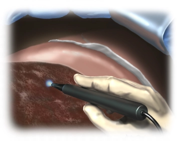 Check for Hemostasis
