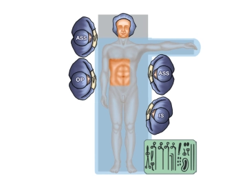 Operating room setup