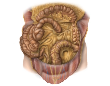 Transverse colon, descending colon, and sigmoid colon 