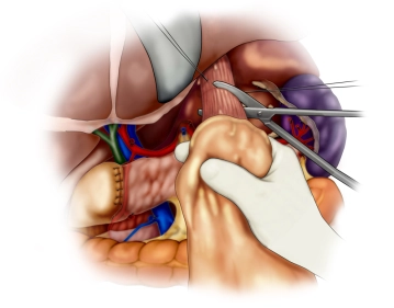 Transecting the specimen