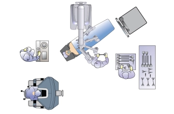 Positioning and Setup 1