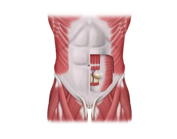 Anatomy of Spigelian Hernia