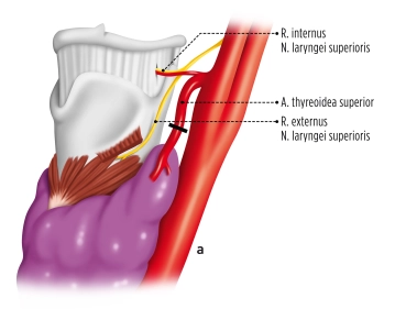 Preparación de los vasos del polo superior