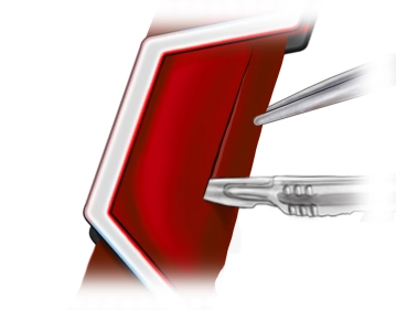 Preparación de la anastomosis arterial