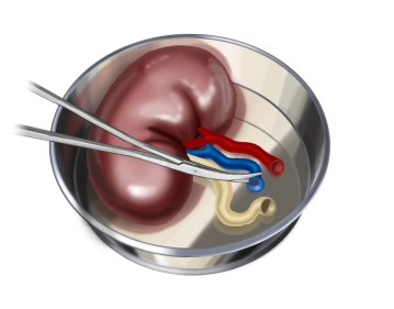 Preparación del riñón donante / Preparación vascular
