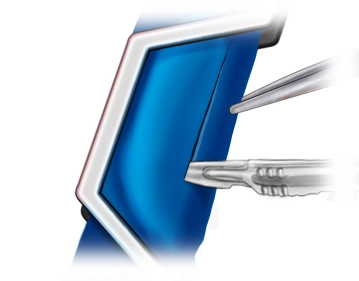 Preparación de la anastomosis venosa