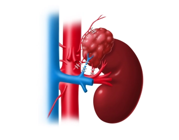 Transecting the arterial blood supply