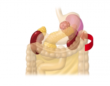 Opening the prerenal space