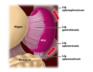Dissecting the spleen off the diaphragm